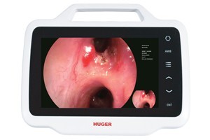 一次性使用内窥镜 VEP-200